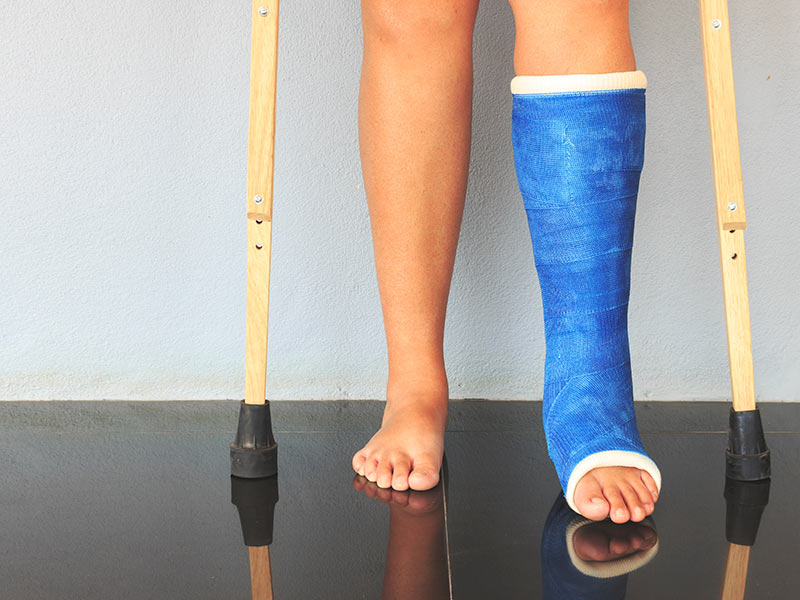 person with a broken leg using crutches