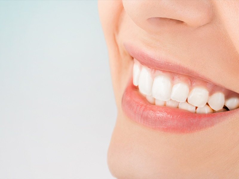 close up of a womans teeth