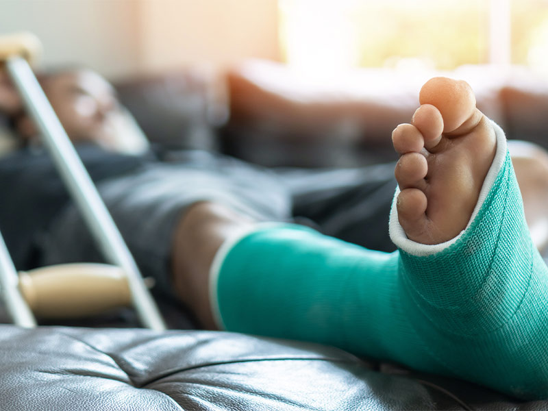 A man laying on a couch with a cast on his foot