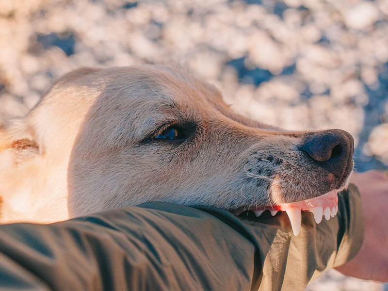 I Was Attacked By a Dog, and It Left Permanent Scarring